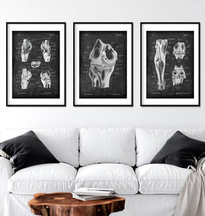 Knee anatomy art print