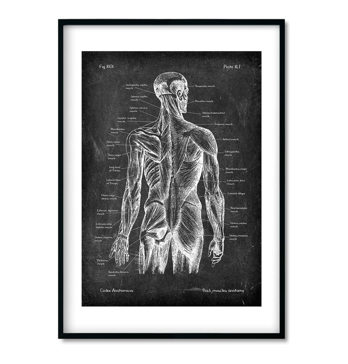 Spine & Back muscles Chalkboard Anatomy Art Set of 3 - Codex Anatomicus