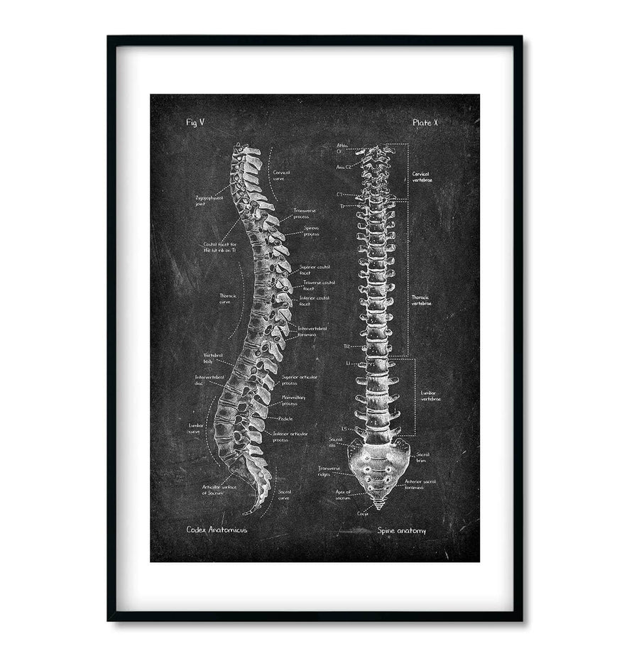 Spine & Back Set of 3 - Chalkboard