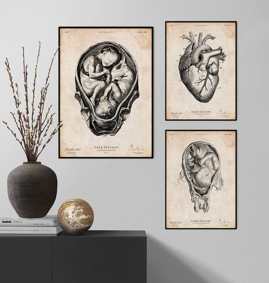 Fetus anatomy art