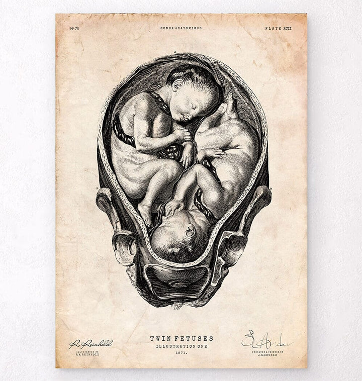 Fetus anatomy poster