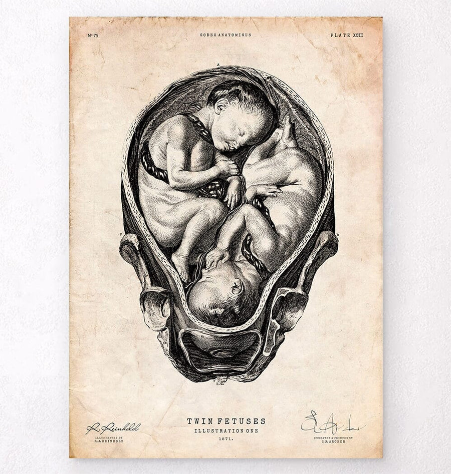 fetus diagram
