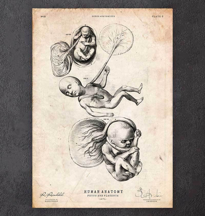 Womb anatomy poster