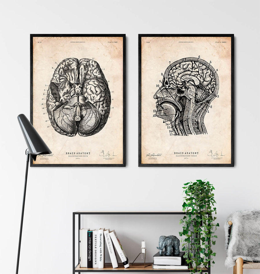 Neurology poster