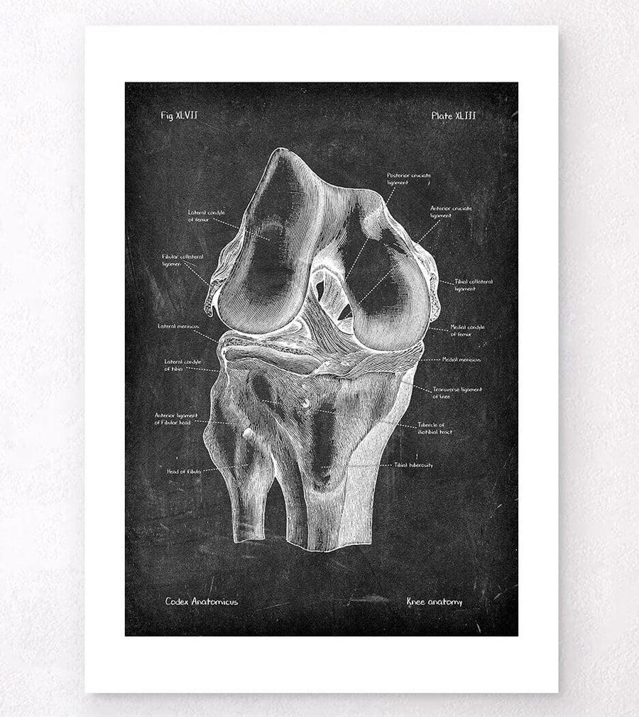 Knie Anatomie - Chalkboard