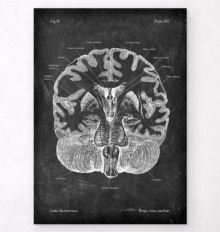 Brain cross section labeled anatomy poster