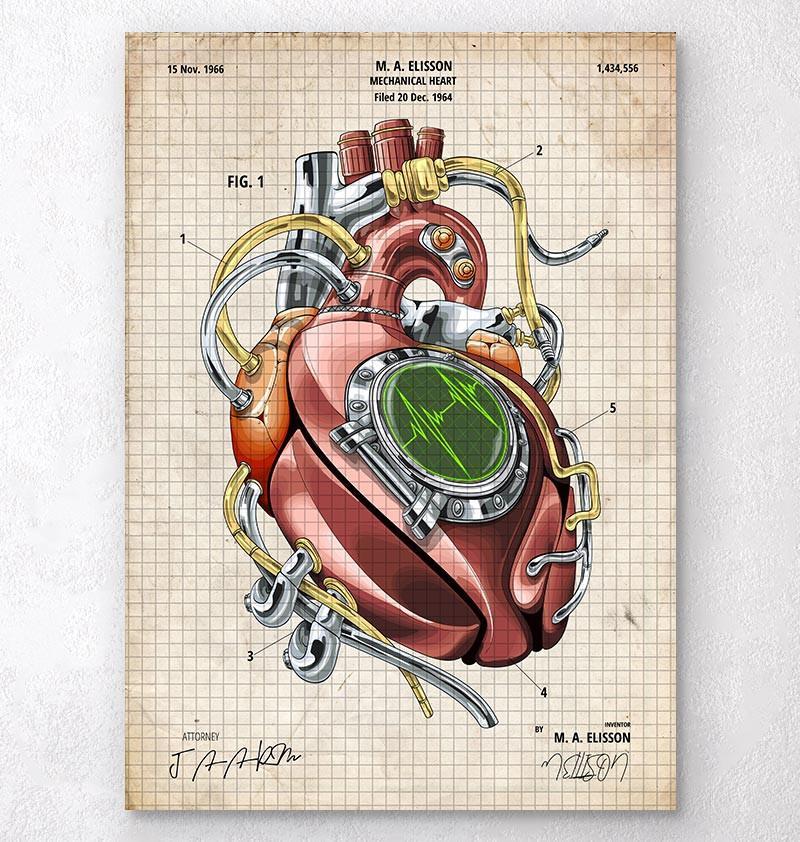 Coeur mécanique