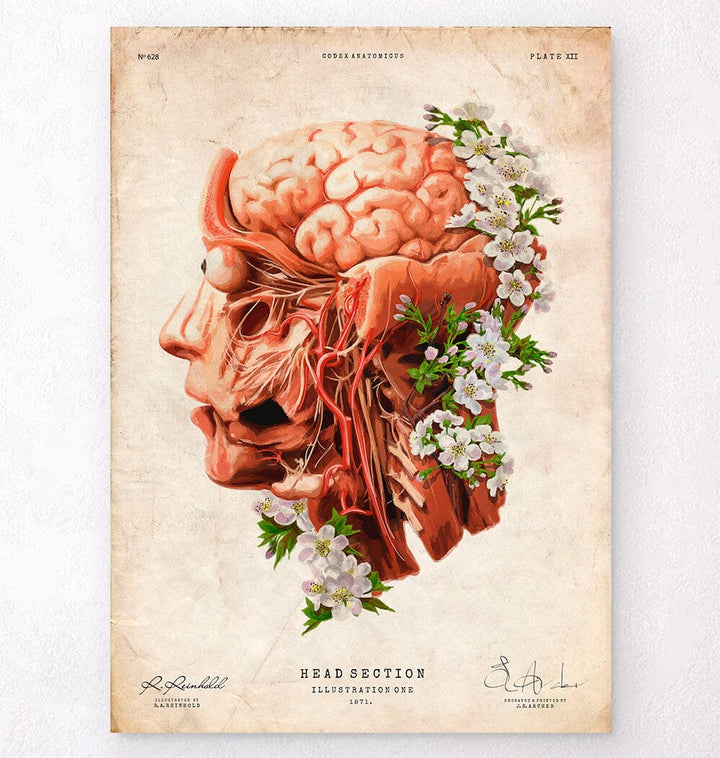 Neck arteries anatomy poster