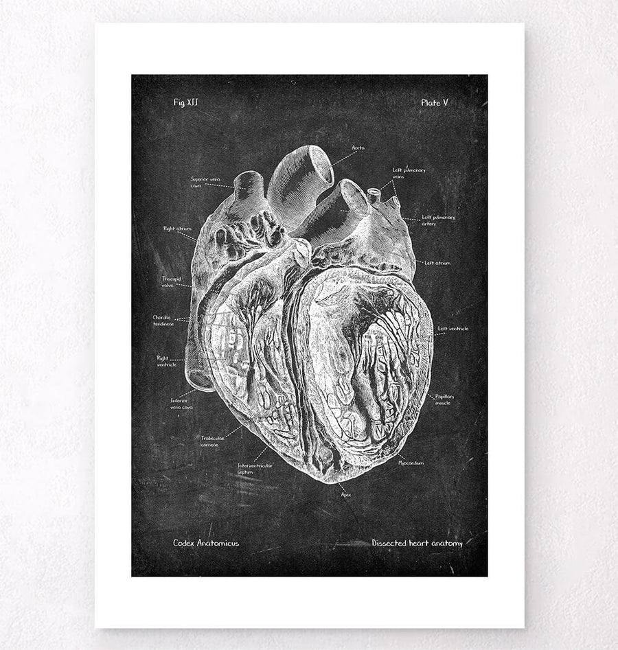 Dissected heart anatomy print