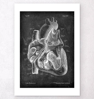Präparierte Herz Anatomie II - Chalkboard