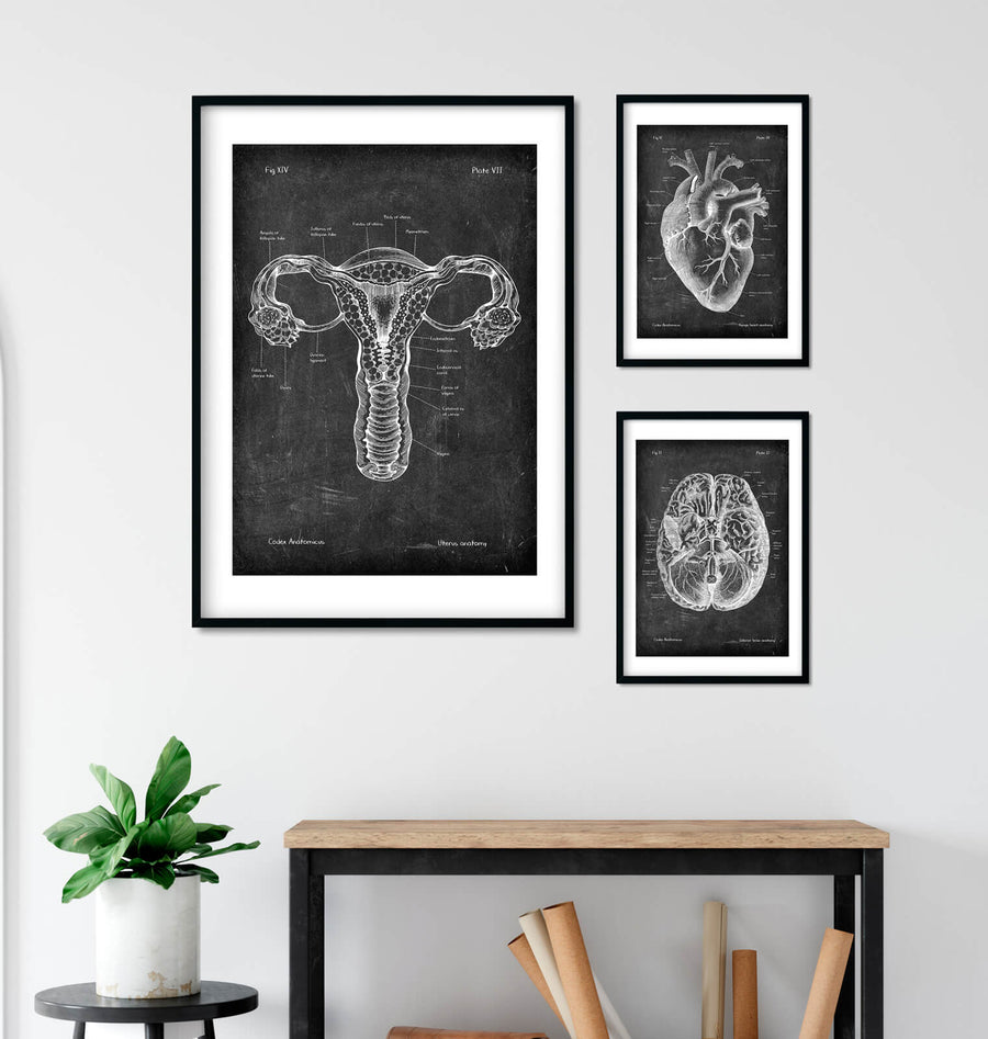 Anatomical uterus poster