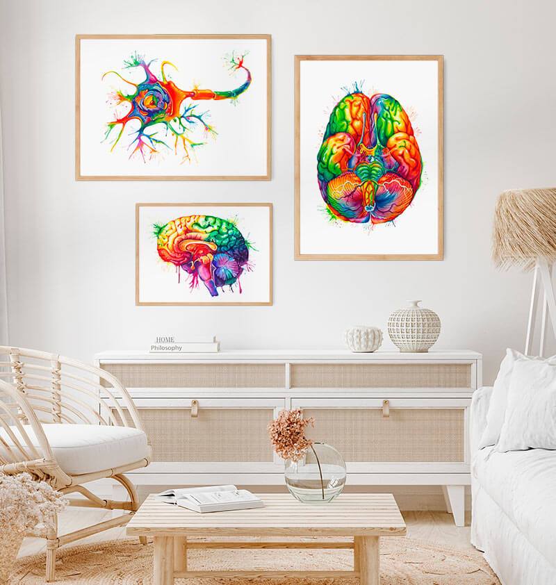 Neurology posters
